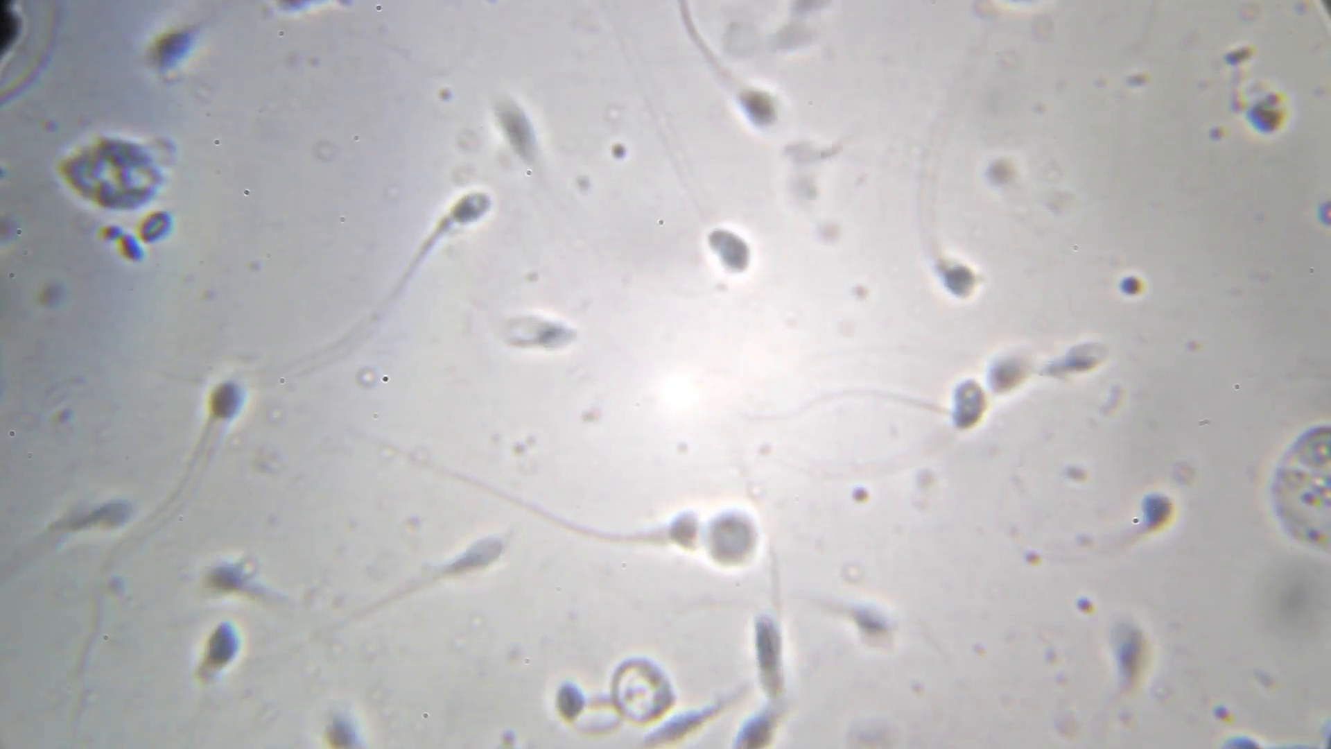 Sperm under microscope video