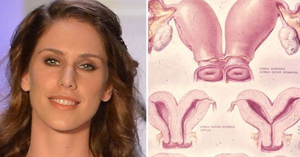Pictures of women with 2 vaginas