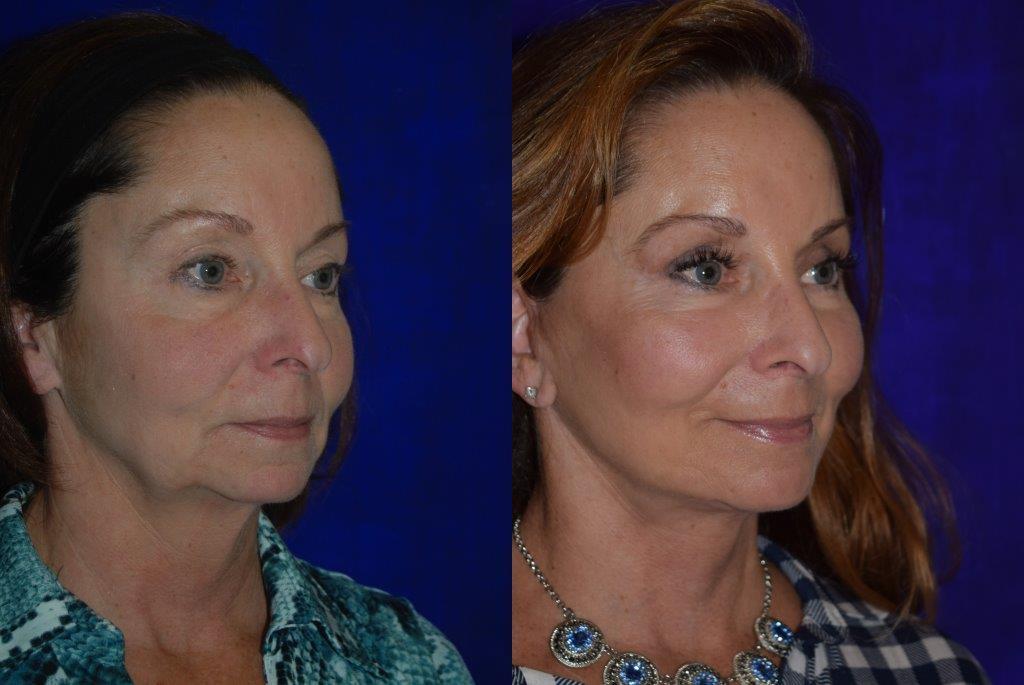 best of Sonoma County surgery reconstructive facial
