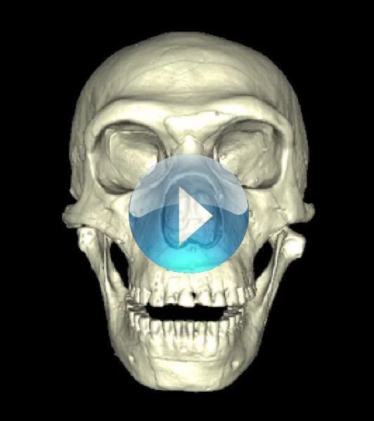 Combo reccomend Facial appearences of ngandong skulls