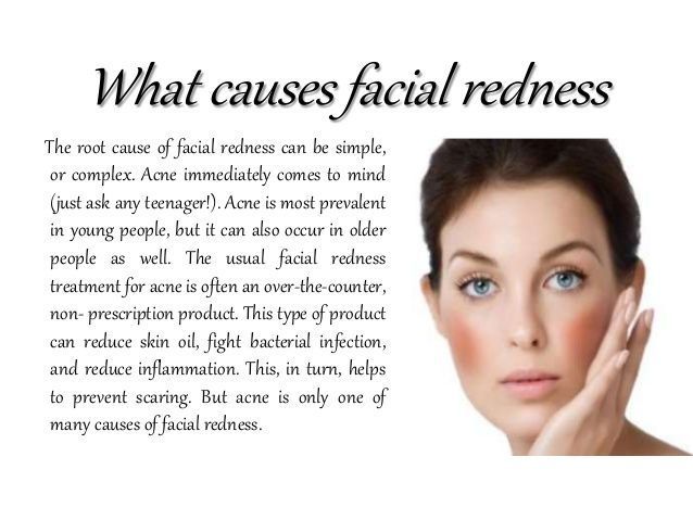 Treating facial redness
