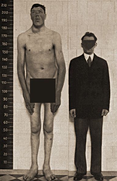 How tall is a midget