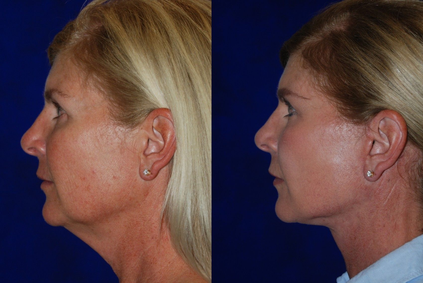 best of Sonoma County surgery reconstructive facial