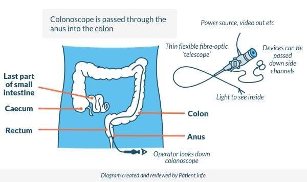 Anal enema colonoscope