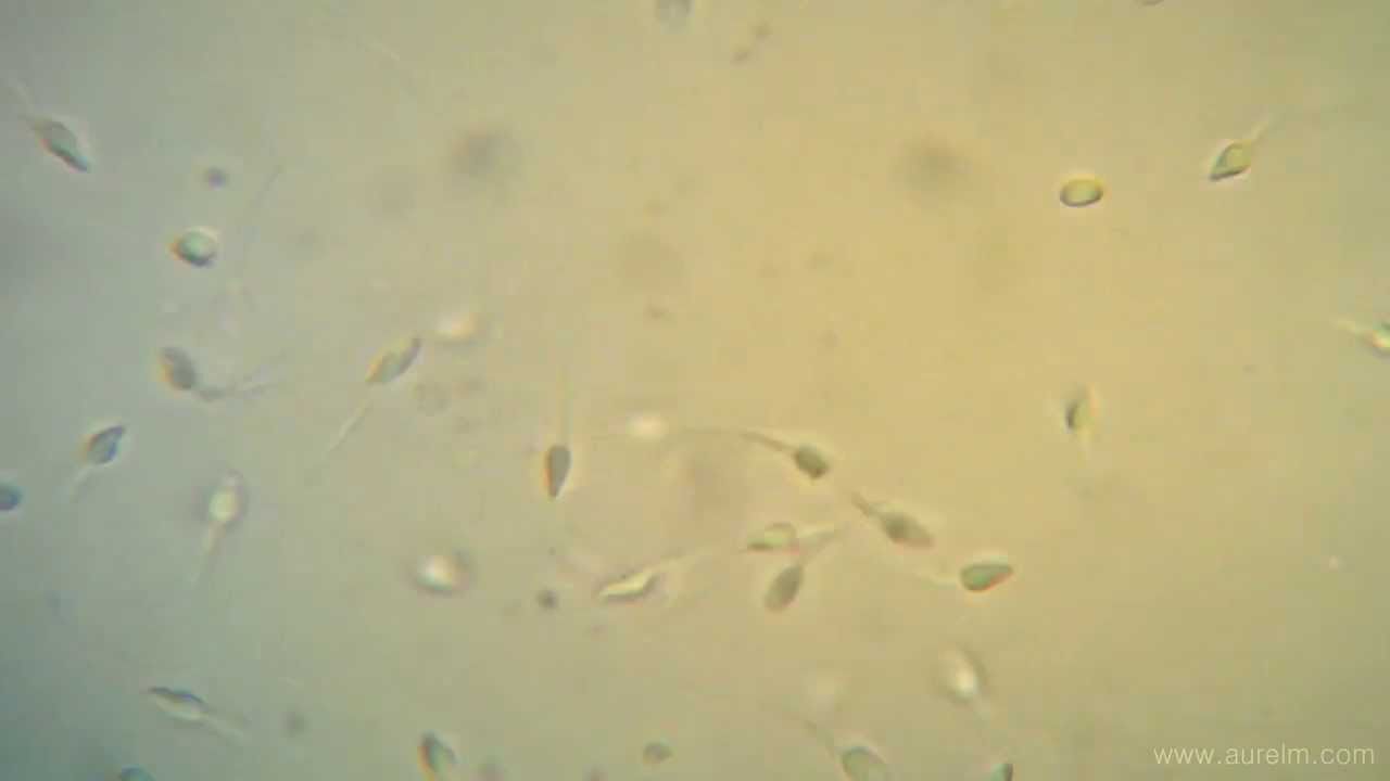 best of Video Sperm under microscope