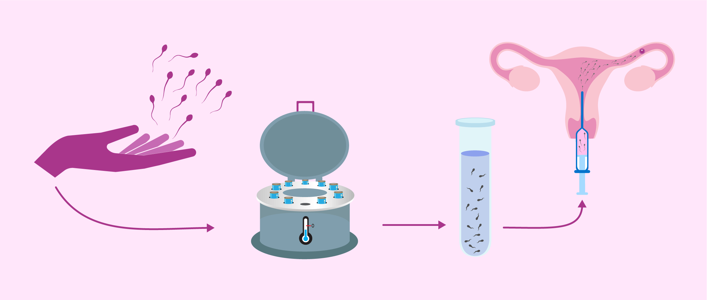 Sperm donor insemination costs