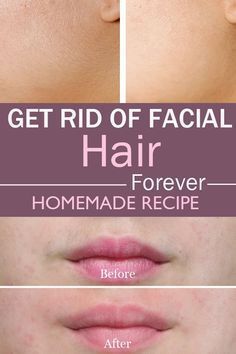 Remove coarse facial hair
