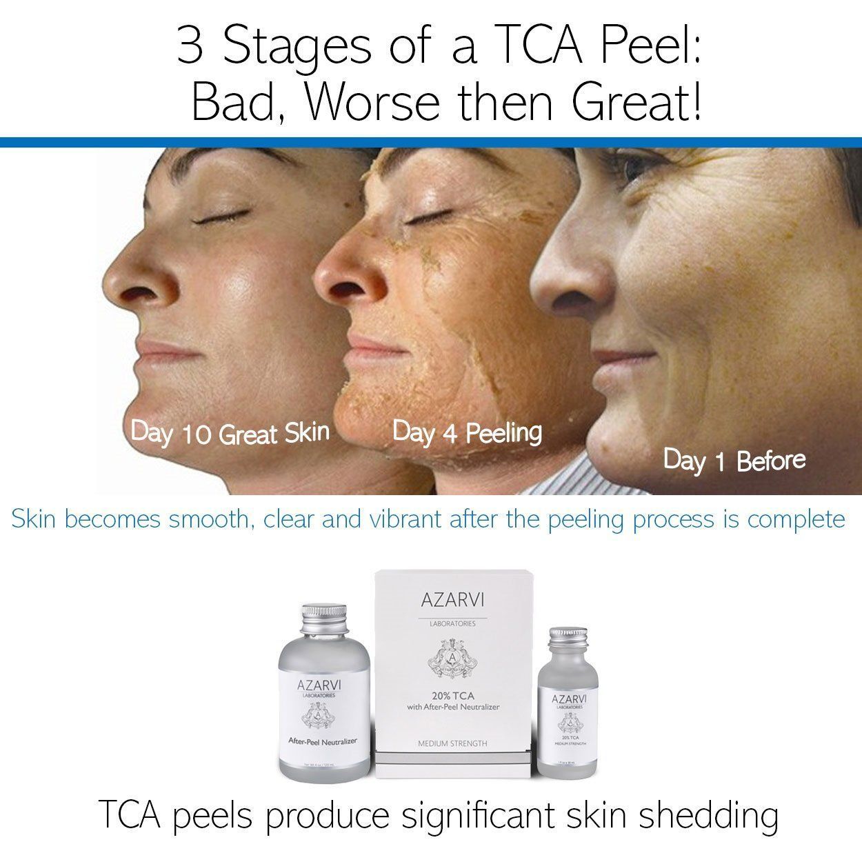 best of Peels gone wrong Facial severn chemical