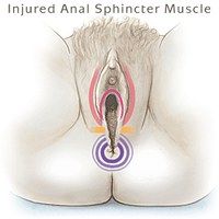 Anal sex + loose anus + bowel movements