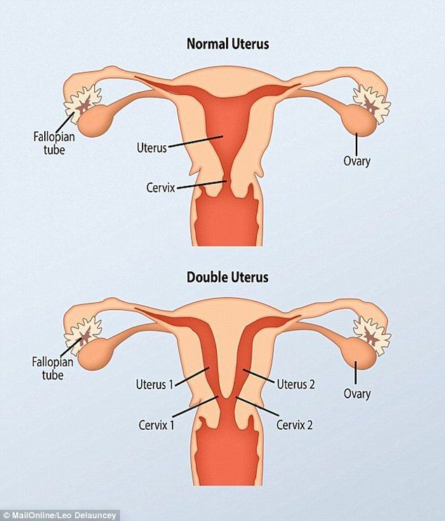 Woman with 2 vaginas pictures