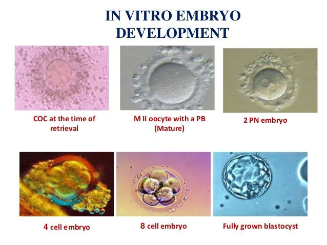 Crusher reccomend Ivf oocyte mature multiple pn