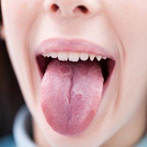 best of Coating oral from sex Black tongue