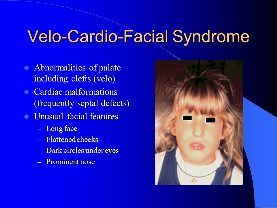 Black D. reccomend Cardio facial syndrome velo