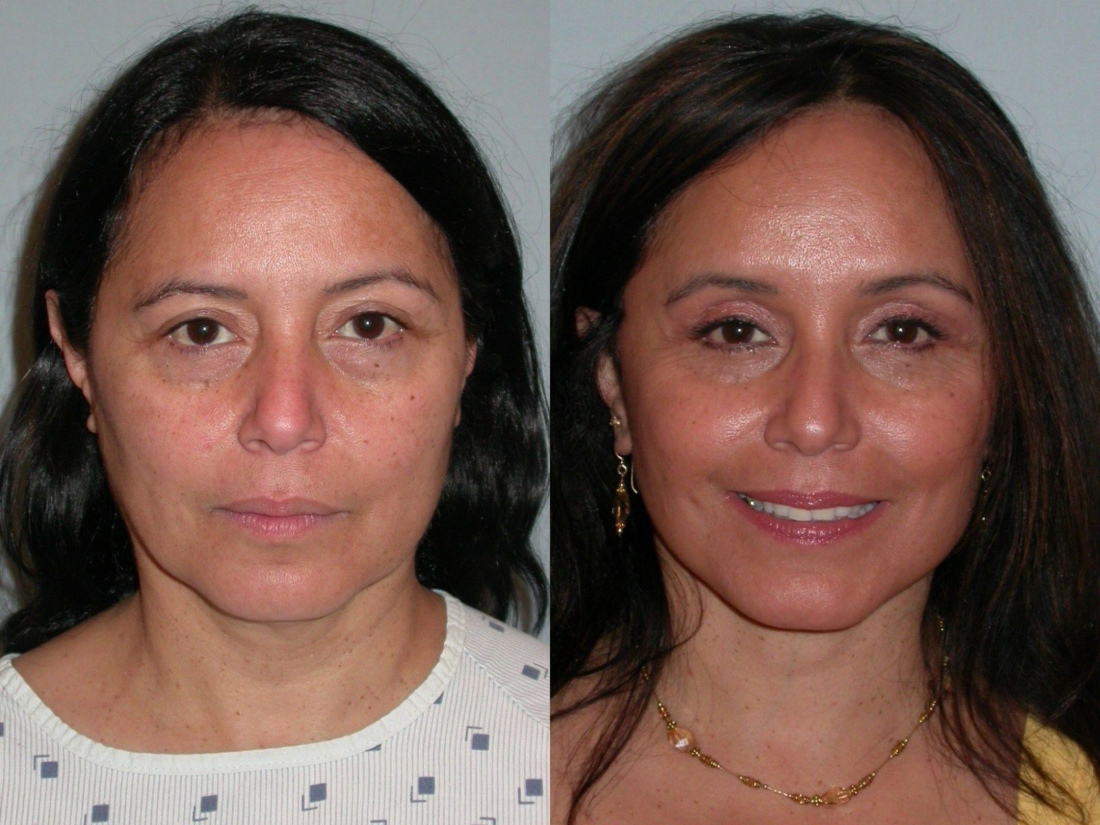 County facial reconstructive sonoma surgery