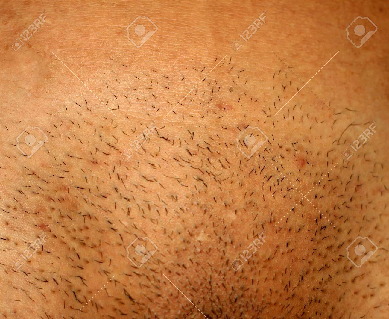 Images of shaved pubis
