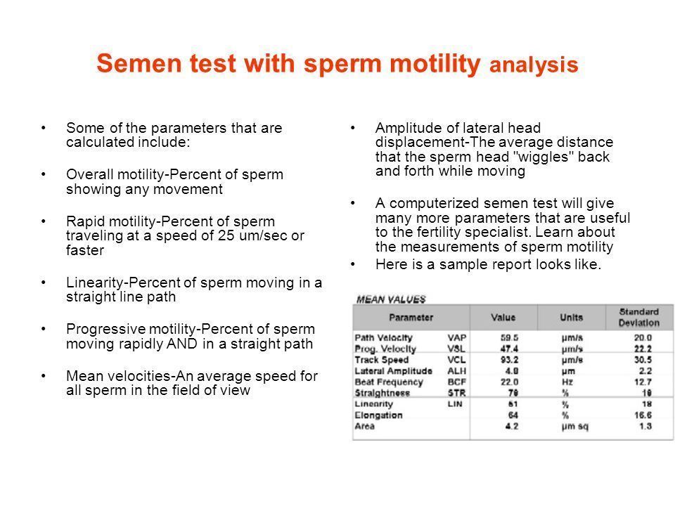 Big B. reccomend Motility of aspirated sperm