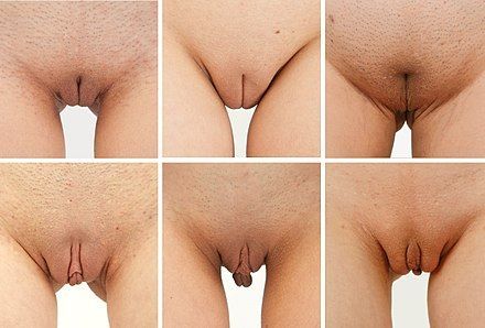 Photos Of Large Clitoris