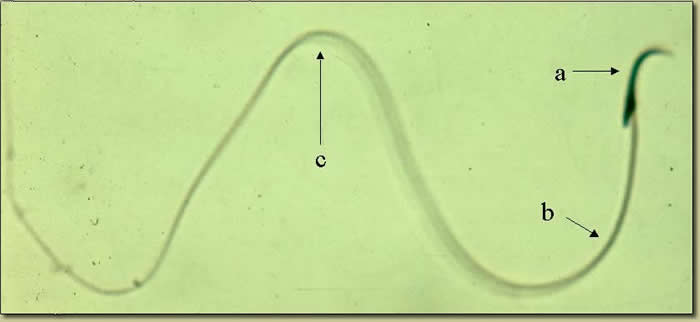 best of Sperm microscopic slide Rat