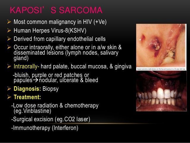 Saliva herpes lick skin