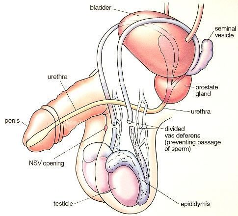 best of Sperm Vasectomy blood in